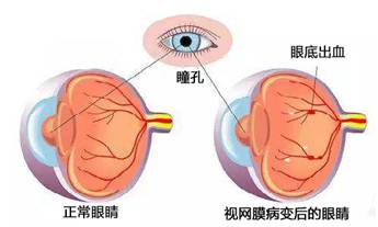 去除川字纹最好的安全的办法最新,去除川字纹的最佳安全办法最新探讨